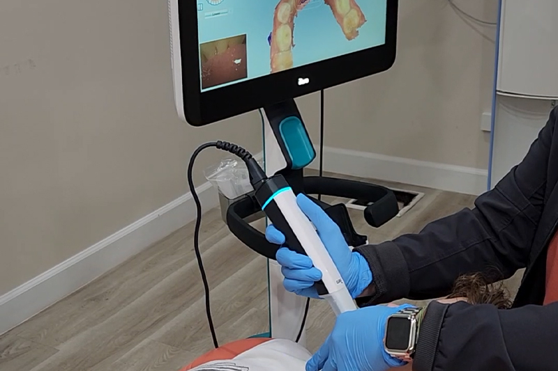 iTero Digital Scans in Palm Harbor