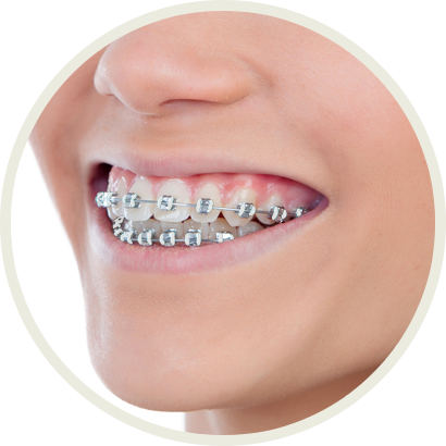 Invisalign Clear Aligners, Wagner Dental