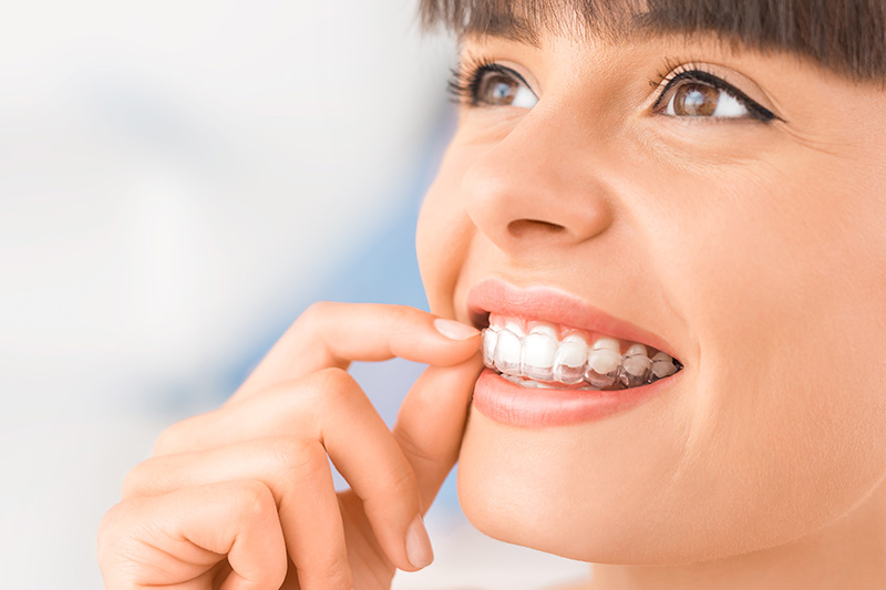 Invisalign in Palm Harbor